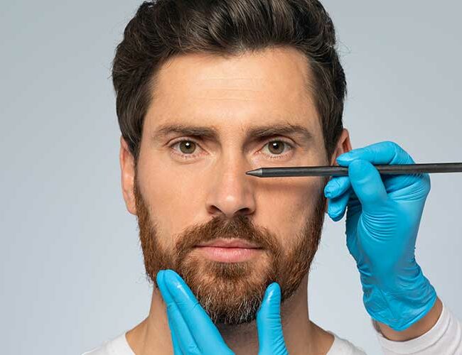 Rhinoplastie médicale à Bordeaux